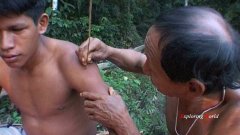 matses-9